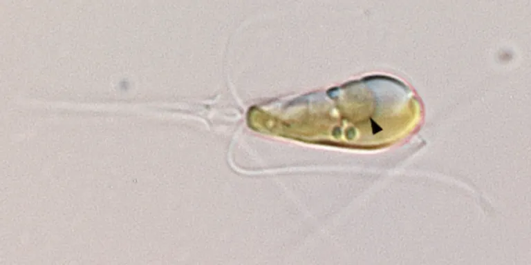  nematode nematode worm roundworm flatworm platyhelminth ocarina sweet potato isopod-0